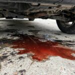 Red transmission fluid puddle leaking under a parked car in a driveway